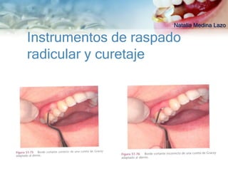 Natalia Medina Lazo

Instrumentos de raspado
radicular y curetaje
 
