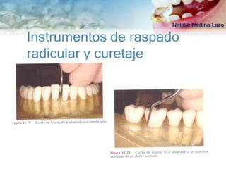 Natalia Medina Lazo

Instrumentos de raspado
radicular y curetaje
 