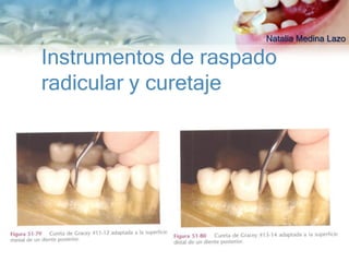 Natalia Medina Lazo

Instrumentos de raspado
radicular y curetaje
 