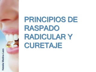 PRINCIPIOS DE
                      RASPADO
                      RADICULAR Y
                      CURETAJE
Natalia Medina Lazo
 