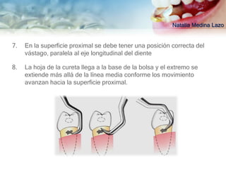 Natalia Medina Lazo


7.   En la superficie proximal se debe tener una posición correcta del
     vástago, paralela al eje longitudinal del diente

8.   La hoja de la cureta llega a la base de la bolsa y el extremo se
     extiende más allá de la línea media conforme los movimiento
     avanzan hacia la superficie proximal.
 