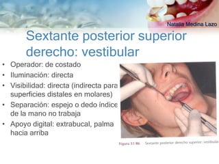 Natalia Medina Lazo

       Sextante posterior superior
       derecho: vestibular
• Operador: de costado
• Iluminación: directa
• Visibilidad: directa (indirecta para
  superficies distales en molares)
• Separación: espejo o dedo índice
  de la mano no trabaja
• Apoyo digital: extrabucal, palma
  hacia arriba
 