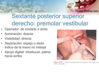 Natalia Medina Lazo

       Sextante posterior superior
       derecho: premolar vestibular
• Operador: de costado o atrás
• Iluminación: directa
• Visibilidad: directa
• Separación: espejo o dedo
  índice de la mano no trabaja
• Apoyo digital: intrabucal, palma
  hacia arriba
 