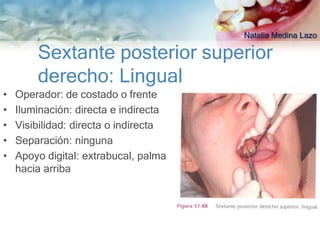 Natalia Medina Lazo

        Sextante posterior superior
        derecho: Lingual
•   Operador: de costado o frente
•   Iluminación: directa e indirecta
•   Visibilidad: directa o indirecta
•   Separación: ninguna
•   Apoyo digital: extrabucal, palma
    hacia arriba
 