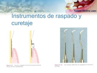 Natalia Medina Lazo

Instrumentos de raspado y
curetaje
 