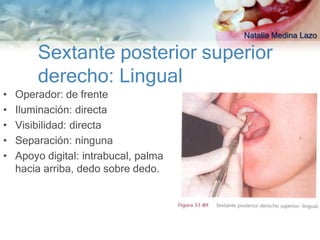 Natalia Medina Lazo

        Sextante posterior superior
        derecho: Lingual
•   Operador: de frente
•   Iluminación: directa
•   Visibilidad: directa
•   Separación: ninguna
•   Apoyo digital: intrabucal, palma
    hacia arriba, dedo sobre dedo.
 