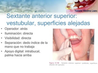 Natalia Medina Lazo

    Sextante anterior superior:
    vestubular, superficies alejadas
• Operador: atrás
• Iluminación: directa
• Visibilidad: directa
• Separación: dedo índice de la
  mano que no trabaja
• Apoyo digital: intrabucal,
  palma hacia arriba
 