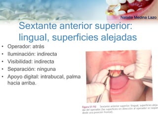 Natalia Medina Lazo

        Sextante anterior superior:
        lingual, superficies alejadas
•   Operador: atrás
•   Iluminación: indirecta
•   Visibilidad: indirecta
•   Separación: ninguna
•   Apoyo digital: intrabucal, palma
    hacia arriba.
 