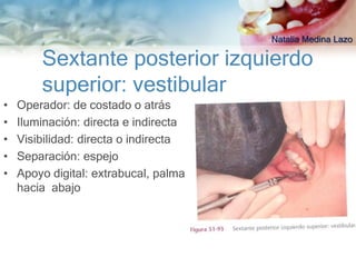 Natalia Medina Lazo

        Sextante posterior izquierdo
        superior: vestibular
•   Operador: de costado o atrás
•   Iluminación: directa e indirecta
•   Visibilidad: directa o indirecta
•   Separación: espejo
•   Apoyo digital: extrabucal, palma
    hacia abajo
 