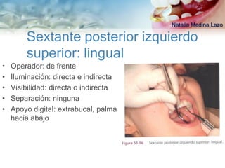 Natalia Medina Lazo

        Sextante posterior izquierdo
        superior: lingual
•   Operador: de frente
•   Iluminación: directa e indirecta
•   Visibilidad: directa o indirecta
•   Separación: ninguna
•   Apoyo digital: extrabucal, palma
    hacia abajo
 