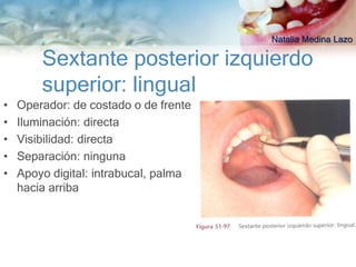 Natalia Medina Lazo

        Sextante posterior izquierdo
        superior: lingual
•   Operador: de costado o de frente
•   Iluminación: directa
•   Visibilidad: directa
•   Separación: ninguna
•   Apoyo digital: intrabucal, palma
    hacia arriba
 