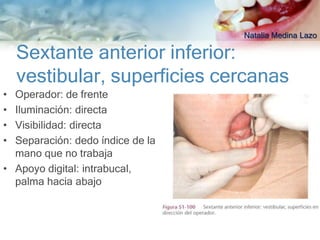 Natalia Medina Lazo

    Sextante anterior inferior:
    vestibular, superficies cercanas
• Operador: de frente
• Iluminación: directa
• Visibilidad: directa
• Separación: dedo índice de la
  mano que no trabaja
• Apoyo digital: intrabucal,
  palma hacia abajo
 