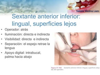 Natalia Medina Lazo

       Sextante anterior inferior:
       lingual, superficies lejos
• Operador: atrás
• Iluminación: directa e indirecta
• Visibilidad: directa e indirecta
• Separación: el espejo retrae la
  lengua
• Apoyo digital: intrabucal,
  palma hacia abajo
 