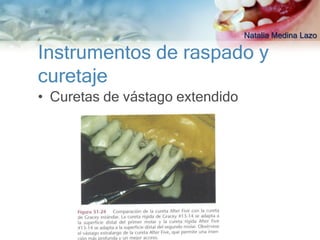 Natalia Medina Lazo

Instrumentos de raspado y
curetaje
• Curetas de vástago extendido
 