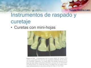 Natalia Medina Lazo

Instrumentos de raspado y
curetaje
• Curetas con mini-hojas
 