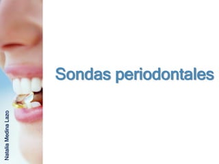 Sondas periodontales
Natalia Medina Lazo
 