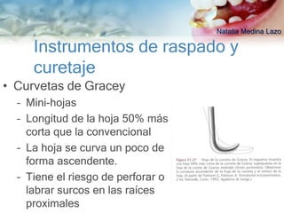 Natalia Medina Lazo

     Instrumentos de raspado y
     curetaje
• Curvetas de Gracey
  – Mini-hojas
  – Longitud de la hoja 50% más
    corta que la convencional
  – La hoja se curva un poco de
    forma ascendente.
  – Tiene el riesgo de perforar o
    labrar surcos en las raíces
    proximales
 