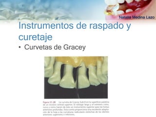 Natalia Medina Lazo

Instrumentos de raspado y
curetaje
• Curvetas de Gracey
 