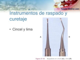 Natalia Medina Lazo

Instrumentos de raspado y
curetaje

• Cincel y lima
 