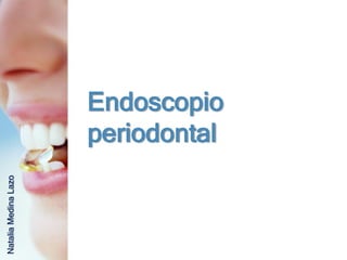 Endoscopio
                      periodontal
Natalia Medina Lazo
 