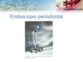 Natalia Medina Lazo



Endoscopio periodontal
 