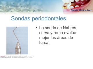 Natalia Medina Lazo



Sondas periodontales
        • La sonda de Nabers
          curva y roma evalúa
          mejor las áreas de
          furca.
 