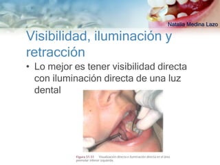 Natalia Medina Lazo

Visibilidad, iluminación y
retracción
• Lo mejor es tener visibilidad directa
  con iluminación directa de una luz
  dental
 