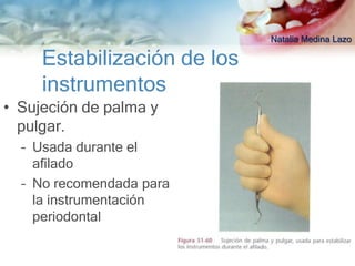 Natalia Medina Lazo

     Estabilización de los
     instrumentos
• Sujeción de palma y
  pulgar.
  – Usada durante el
    afilado
  – No recomendada para
    la instrumentación
    periodontal
 