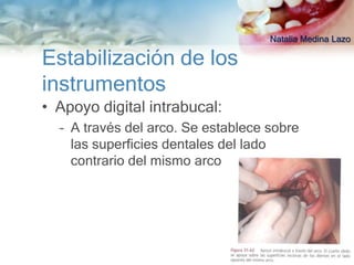 Natalia Medina Lazo

Estabilización de los
instrumentos
• Apoyo digital intrabucal:
  – A través del arco. Se establece sobre
    las superficies dentales del lado
    contrario del mismo arco
 