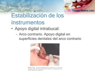 Natalia Medina Lazo

Estabilización de los
instrumentos
• Apoyo digital intrabucal:
  – Arco contrario. Apoyo digital en
    superficies dentales del arco contrario
 
