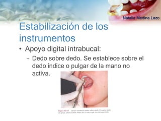 Natalia Medina Lazo

Estabilización de los
instrumentos
• Apoyo digital intrabucal:
  – Dedo sobre dedo. Se establece sobre el
    dedo índice o pulgar de la mano no
    activa.
 