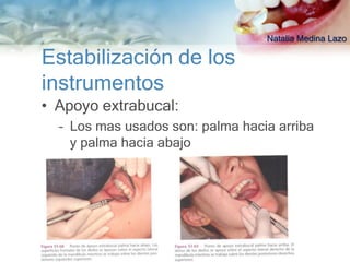 Natalia Medina Lazo

Estabilización de los
instrumentos
• Apoyo extrabucal:
  – Los mas usados son: palma hacia arriba
    y palma hacia abajo
 