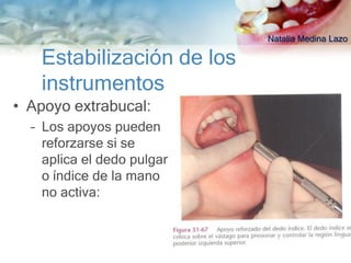 Natalia Medina Lazo

   Estabilización de los
   instrumentos
• Apoyo extrabucal:
  – Los apoyos pueden
    reforzarse si se
    aplica el dedo pulgar
    o índice de la mano
    no activa:
 
