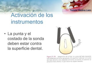 Natalia Medina Lazo

   Activación de los
   instrumentos

• La punta y el
  costado de la sonda
  deben estar contra
  la superficie dental.
 