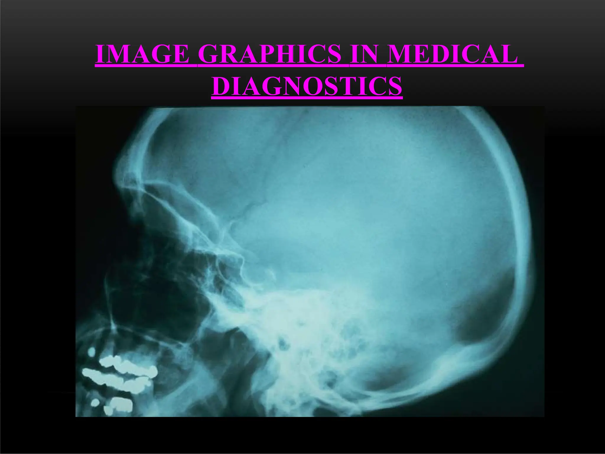 IMAGE GRAPHICS IN MEDICAL
DIAGNOSTICS
 