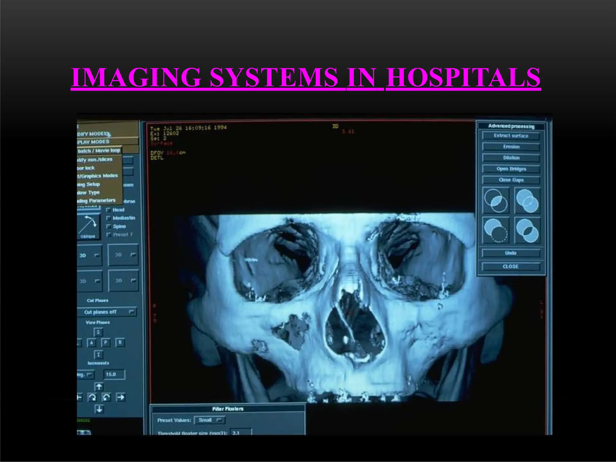 IMAGING SYSTEMS IN HOSPITALS
 