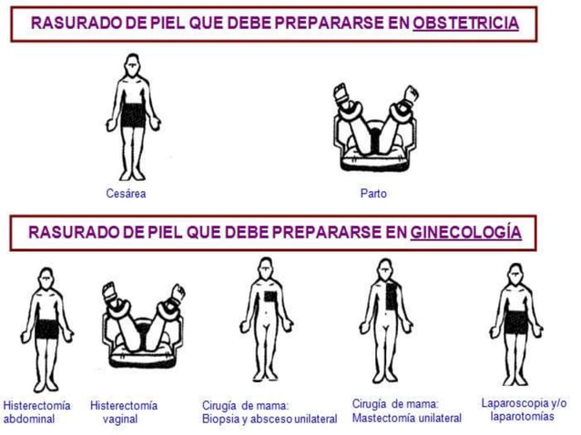 Rasurado Quirúrgico.pptx