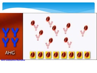 Anti Globulina Humana 
 