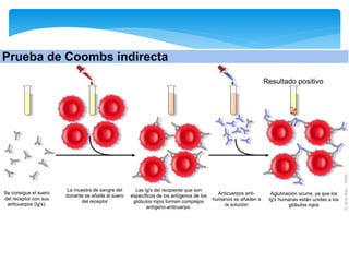 Reacciones Agudas Transfusionales