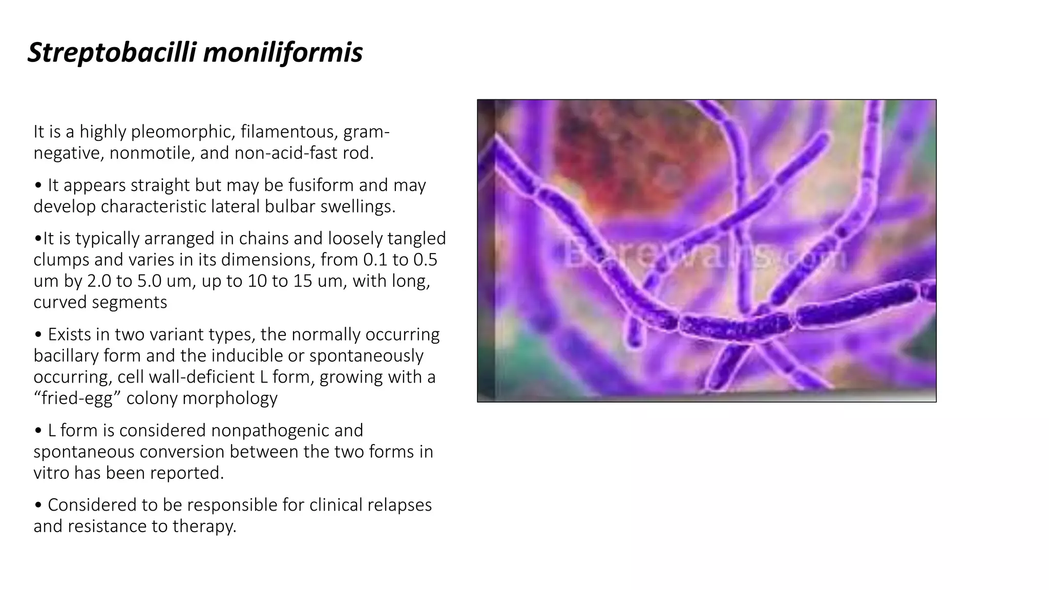 Fuiform Rods Rat bite fever | PDF