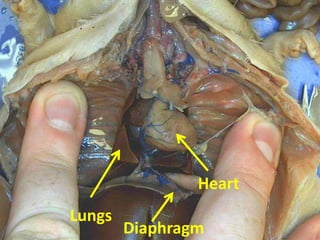 Heart
Lungs
        Diaphragm
 