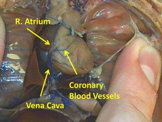 R. Atrium




              Coronary
              Blood Vessels
  Vena Cava
 
