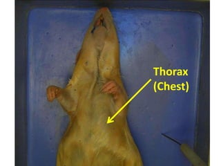 Thorax
(Chest)
 