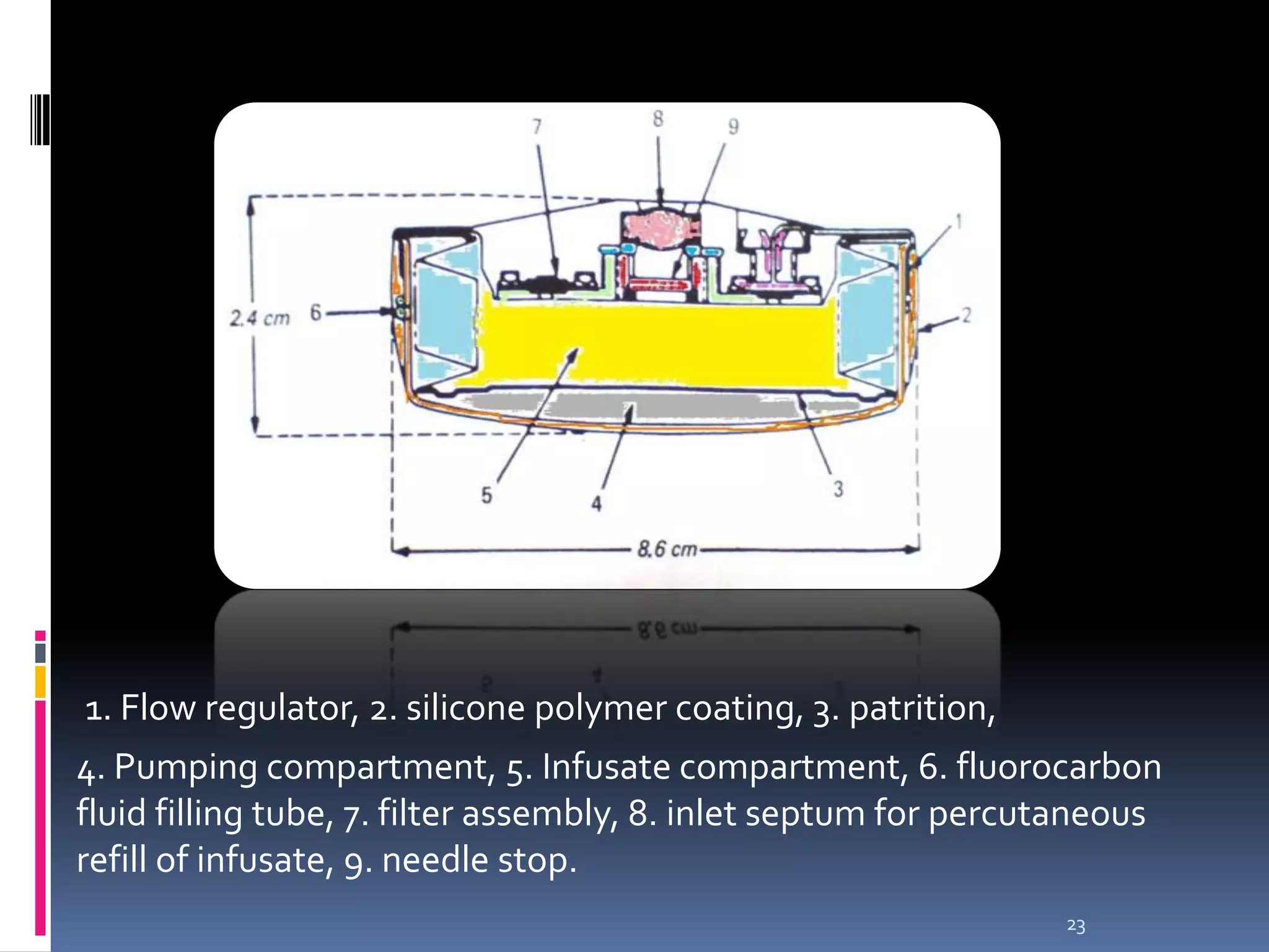 1. Flow regulator, 2. silicone polymer coating, 3. patrition,
4. Pumping compartment, 5. Infusate compartment, 6. fluorocarbon
fluid filling tube, 7. filter assembly, 8. inlet septum for percutaneous
refill of infusate, 9. needle stop.
                                                                 23
 