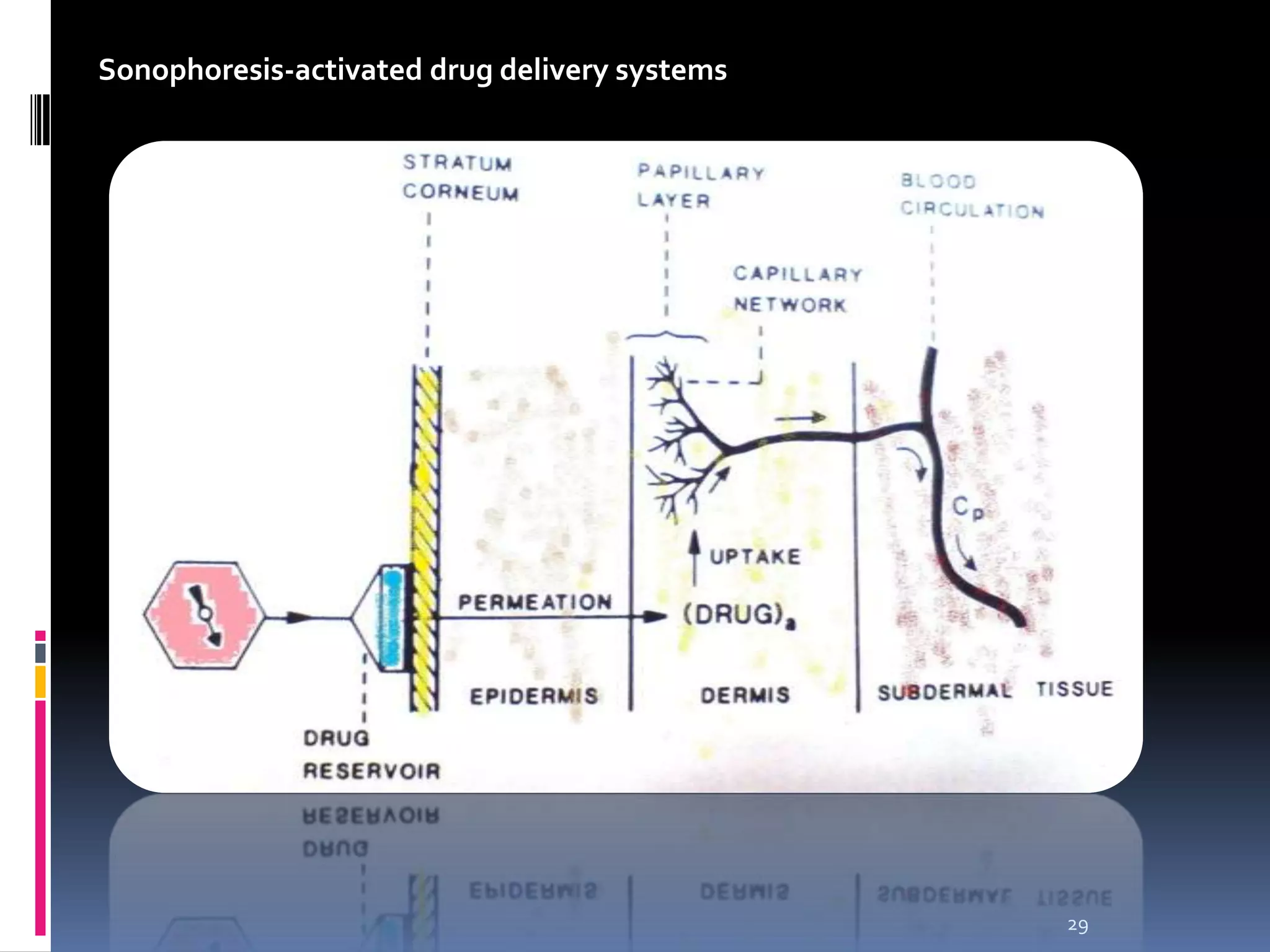 Sonophoresis-activated drug delivery systems




                                               29
 