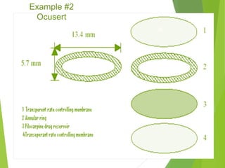 June 5, 2016 14
Example #2
Ocusert
 