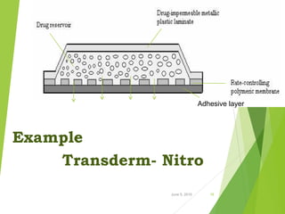 D
Example
Transderm- Nitro
June 5, 2016 16
Adhesive layer
 