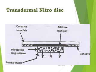 Transdermal Nitro disc
June 5, 2016 26
 