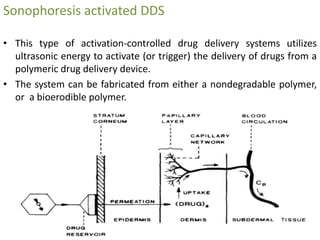Sonophoresis activated DDS
• This type of activation-controlled drug delivery systems utilizes
ultrasonic energy to activate (or trigger) the delivery of drugs from a
polymeric drug delivery device.
• The system can be fabricated from either a nondegradable polymer,
or a bioerodible polymer.
 