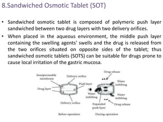 8.Sandwiched Osmotic Tablet (SOT)
• Sandwiched osmotic tablet is composed of polymeric push layer
sandwiched between two drug layers with two delivery orifices.
• When placed in the aqueous environment, the middle push layer
containing the swelling agents' swells and the drug is released from
the two orifices situated on opposite sides of the tablet; thus
sandwiched osmotic tablets (SOTS) can be suitable for drugs prone to
cause local irritation of the gastric mucosa.
 